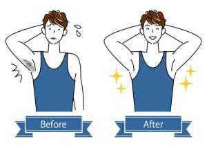 5 places body acne can show up and what to do about it - MSN